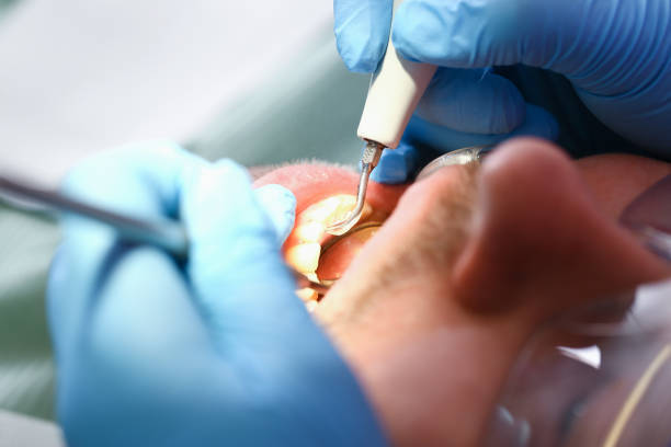 Best Emergency Dental Care for Abscessed Tooth in Ricardo, TX