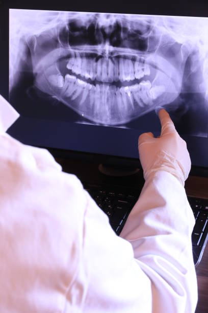 Best Emergency Root Canal Treatment in Ricardo, TX